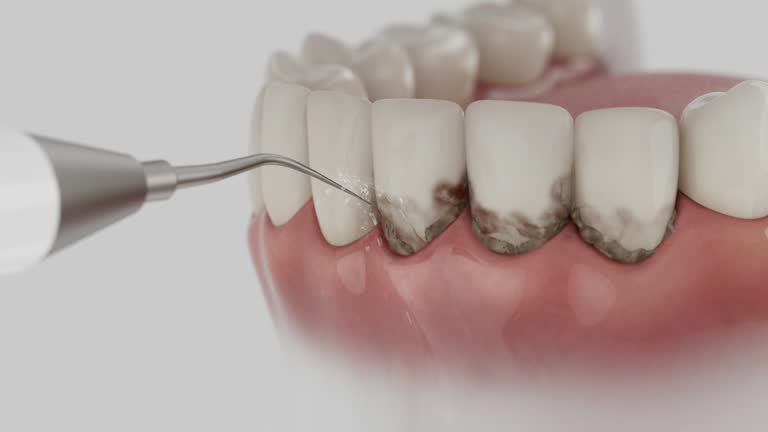 Reliable Emergency Dentist contractor in Avis, PA by Smile Center Dentistry